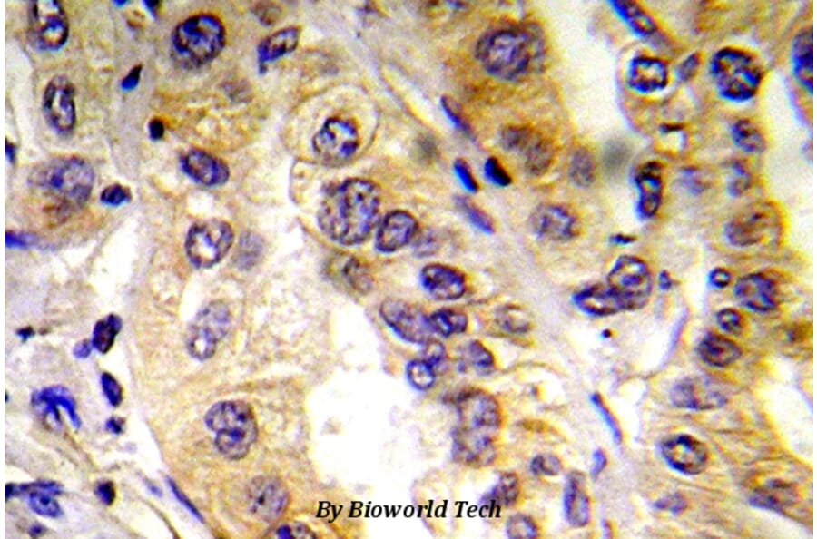 Anti-VEGFR2/Flk-1 (I1181) Antibody from Bioworld Technology (BS5540) - Antibodies.com