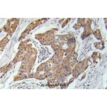 Anti-VEGFR2/Flk-1 (I1220) Antibody from Bioworld Technology (BS5541) - Antibodies.com