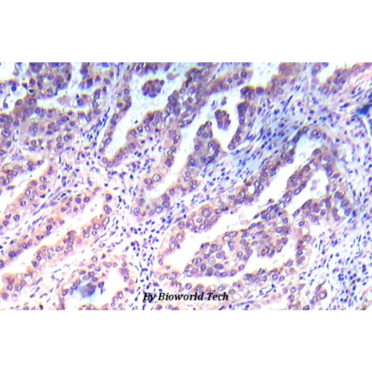 Anti-VEGFR2/Flk-1 (P957) Antibody from Bioworld Technology (BS5542) - Antibodies.com