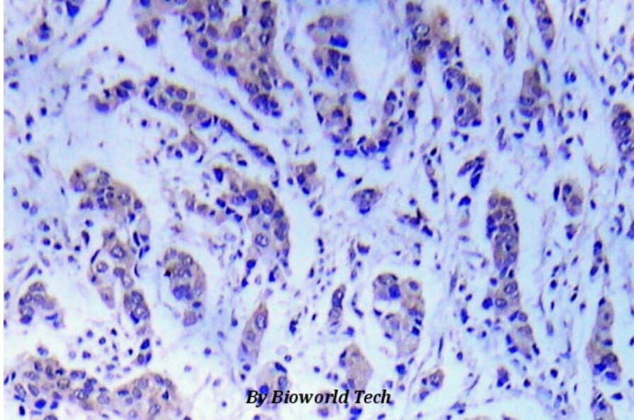 Anti-ASK1 (S89) Antibody from Bioworld Technology (BS5554) - Antibodies.com