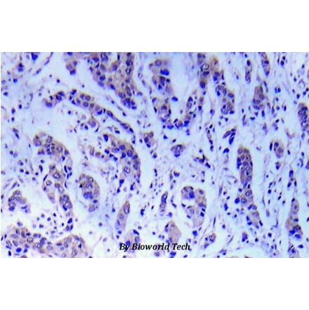 Anti-ASK1 (S89) Antibody from Bioworld Technology (BS5554) - Antibodies.com