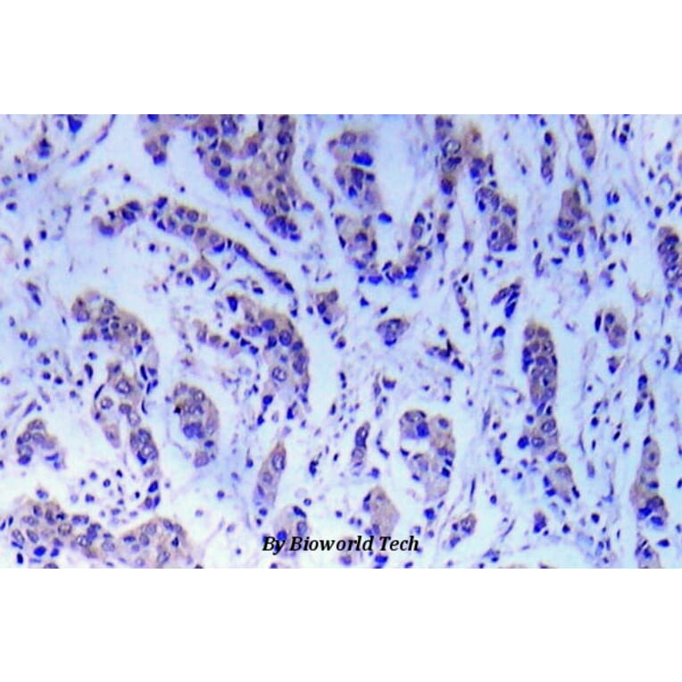 Anti-ASK1 (S89) Antibody from Bioworld Technology (BS5554) - Antibodies.com