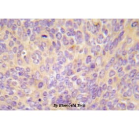 Anti-ASK1 (V972) Antibody from Bioworld Technology (BS5555) - Antibodies.com