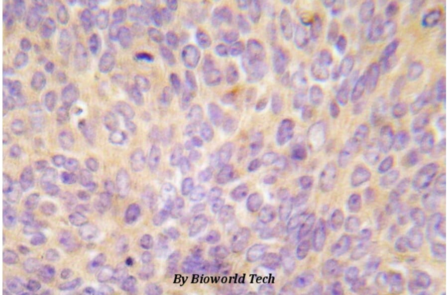 Anti-ASK1 (V972) Antibody from Bioworld Technology (BS5555) - Antibodies.com
