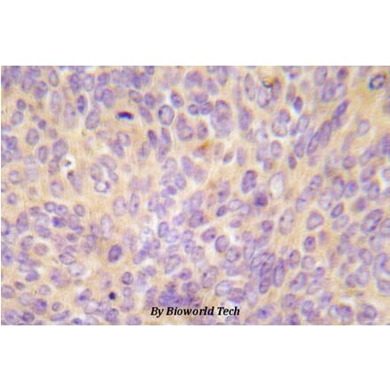 Anti-ASK1 (V972) Antibody from Bioworld Technology (BS5555) - Antibodies.com