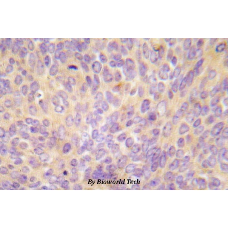 Anti-ASK1 (V972) Antibody from Bioworld Technology (BS5555) - Antibodies.com
