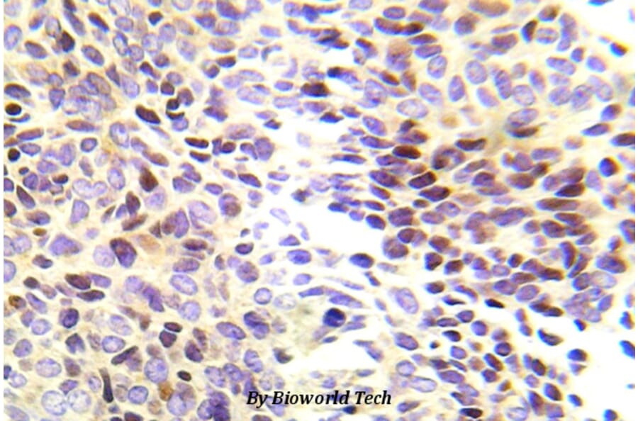 Anti-Chk1 (R323) Antibody from Bioworld Technology (BS5558) - Antibodies.com