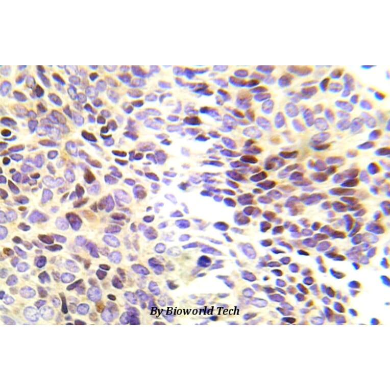 Anti-Chk1 (R323) Antibody from Bioworld Technology (BS5558) - Antibodies.com