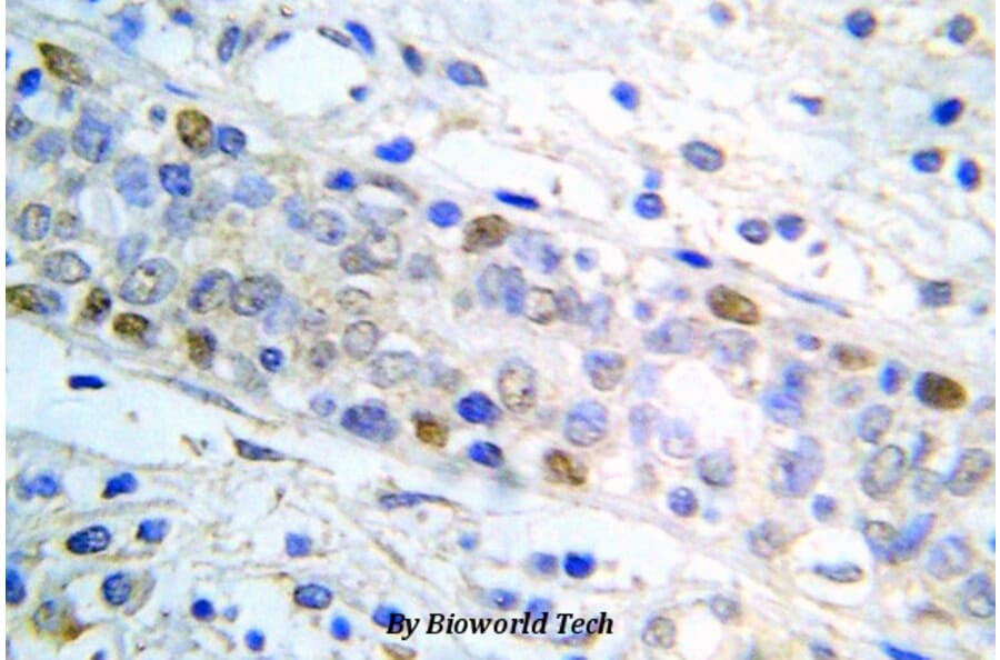 Anti-ERα (P124) Antibody from Bioworld Technology (BS5567) - Antibodies.com