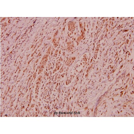 Anti-HDAC1 (E427) Antibody from Bioworld Technology (BS5576) - Antibodies.com
