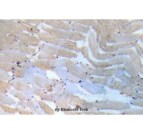 Anti-IKKα/β (Q186) Antibody from Bioworld Technology (BS5580) - Antibodies.com