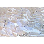 Anti-IKKα/β (Q186) Antibody from Bioworld Technology (BS5580) - Antibodies.com