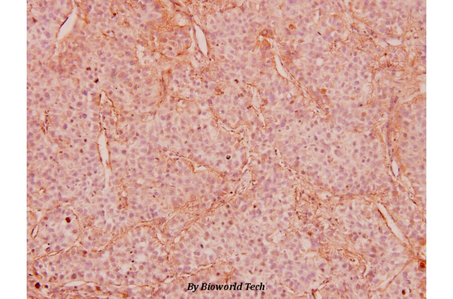 Anti-IRS-1 (P618) Antibody from Bioworld Technology (BS5582) - Antibodies.com