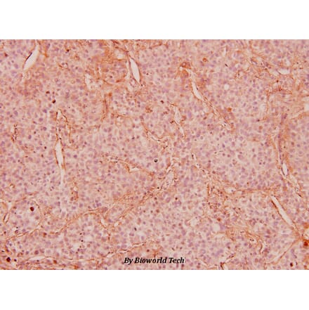 Anti-IRS-1 (P618) Antibody from Bioworld Technology (BS5582) - Antibodies.com