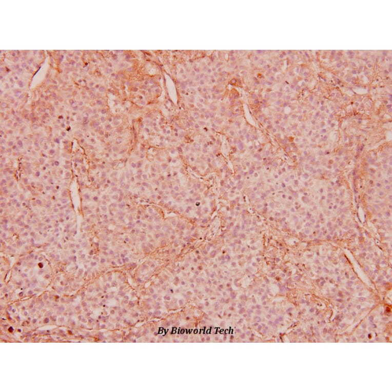 Anti-IRS-1 (P618) Antibody from Bioworld Technology (BS5582) - Antibodies.com