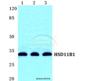 Anti-HSD11B1 Antibody from Bioworld Technology (BS5588) - Antibodies.com