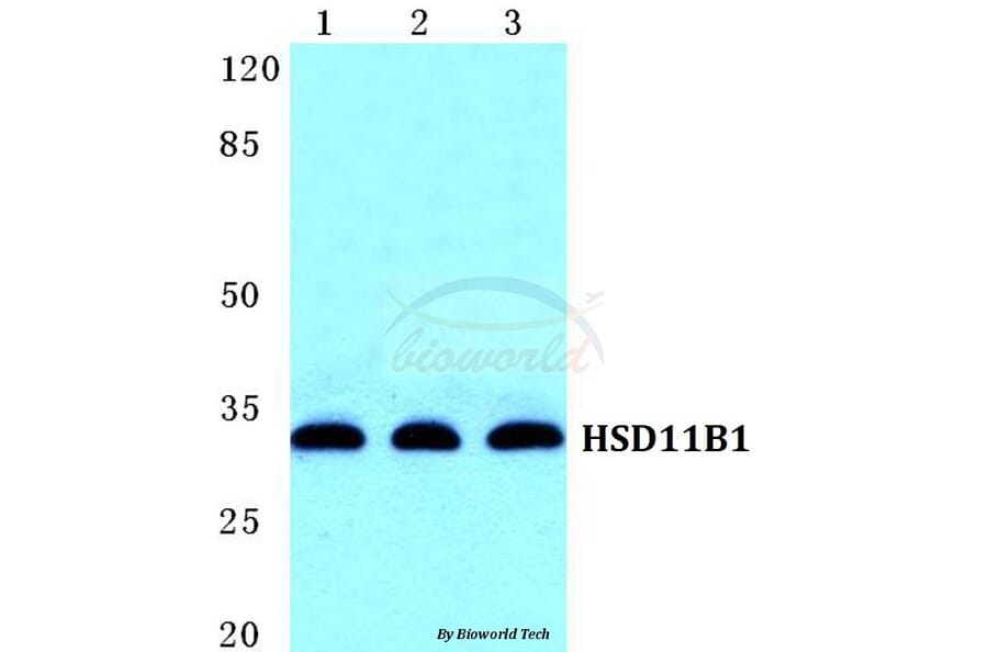Anti-HSD11B1 Antibody from Bioworld Technology (BS5588) - Antibodies.com
