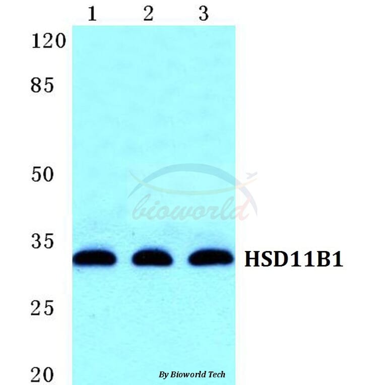 Anti-HSD11B1 Antibody from Bioworld Technology (BS5588) - Antibodies.com