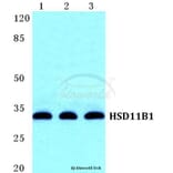 Anti-HSD11B1 Antibody from Bioworld Technology (BS5588) - Antibodies.com