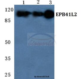 Anti-EPB41L2 Antibody from Bioworld Technology (BS5589) - Antibodies.com