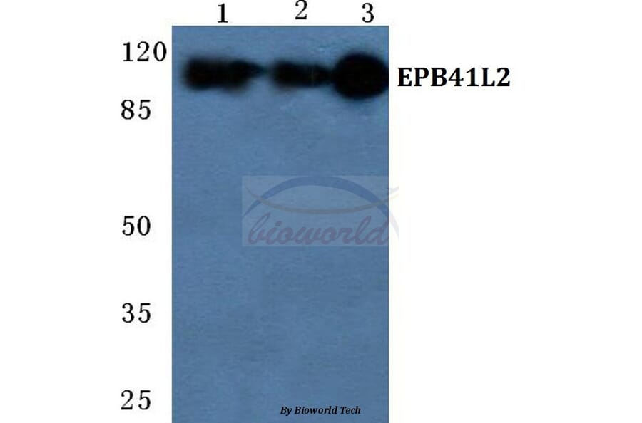Anti-EPB41L2 Antibody from Bioworld Technology (BS5589) - Antibodies.com