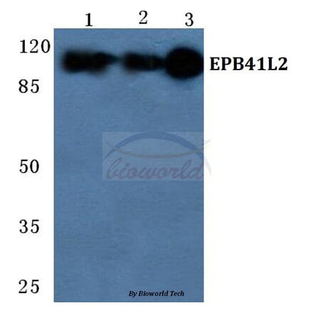 Anti-EPB41L2 Antibody from Bioworld Technology (BS5589) - Antibodies.com