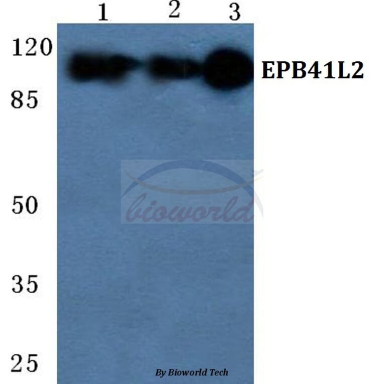 Anti-EPB41L2 Antibody from Bioworld Technology (BS5589) - Antibodies.com