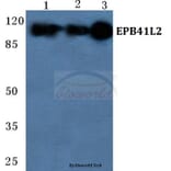 Anti-EPB41L2 Antibody from Bioworld Technology (BS5589) - Antibodies.com