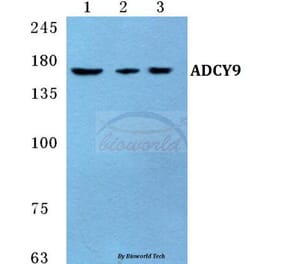 Anti-ADCY9 Antibody from Bioworld Technology (BS5590) - Antibodies.com