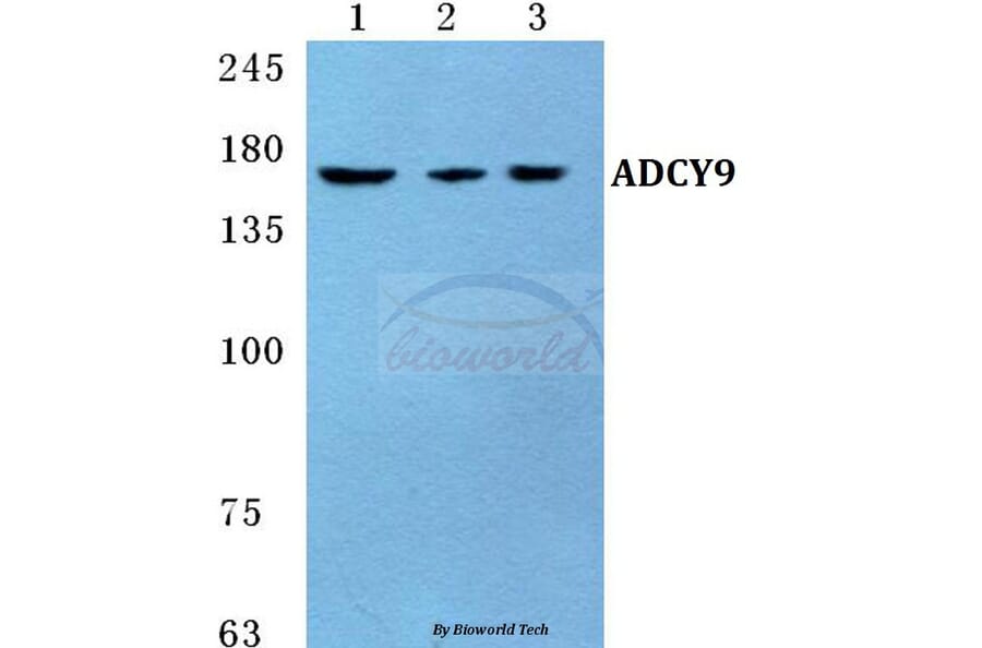 Anti-ADCY9 Antibody from Bioworld Technology (BS5590) - Antibodies.com