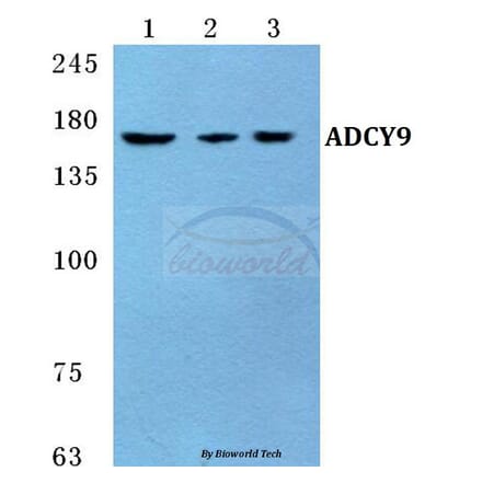 Anti-ADCY9 Antibody from Bioworld Technology (BS5590) - Antibodies.com