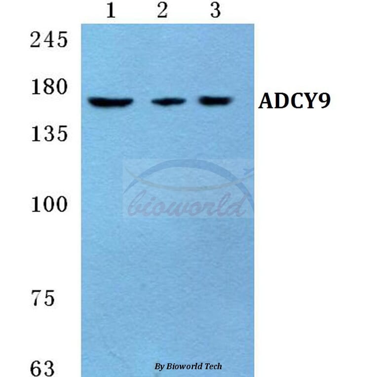 Anti-ADCY9 Antibody from Bioworld Technology (BS5590) - Antibodies.com