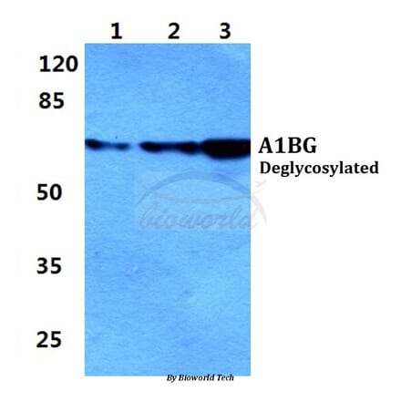 Anti-A1BG Antibody from Bioworld Technology (BS5591) - Antibodies.com