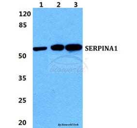 Anti-SERPINA1 Antibody from Bioworld Technology (BS5593) - Antibodies.com