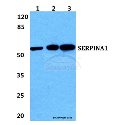 Anti-SERPINA1 Antibody from Bioworld Technology (BS5593) - Antibodies.com