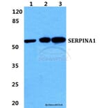 Anti-SERPINA1 Antibody from Bioworld Technology (BS5593) - Antibodies.com
