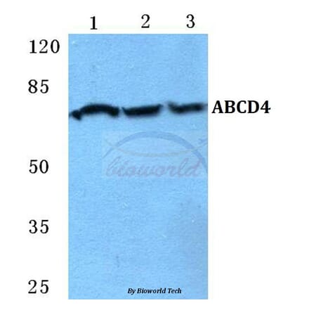 Anti-ABCD4 Antibody from Bioworld Technology (BS5595) - Antibodies.com