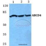 Anti-ABCD4 Antibody from Bioworld Technology (BS5595) - Antibodies.com