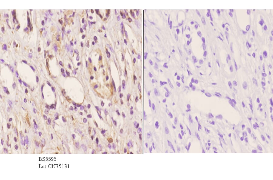 Anti-ABCD4 Antibody from Bioworld Technology (BS5595) - Antibodies.com