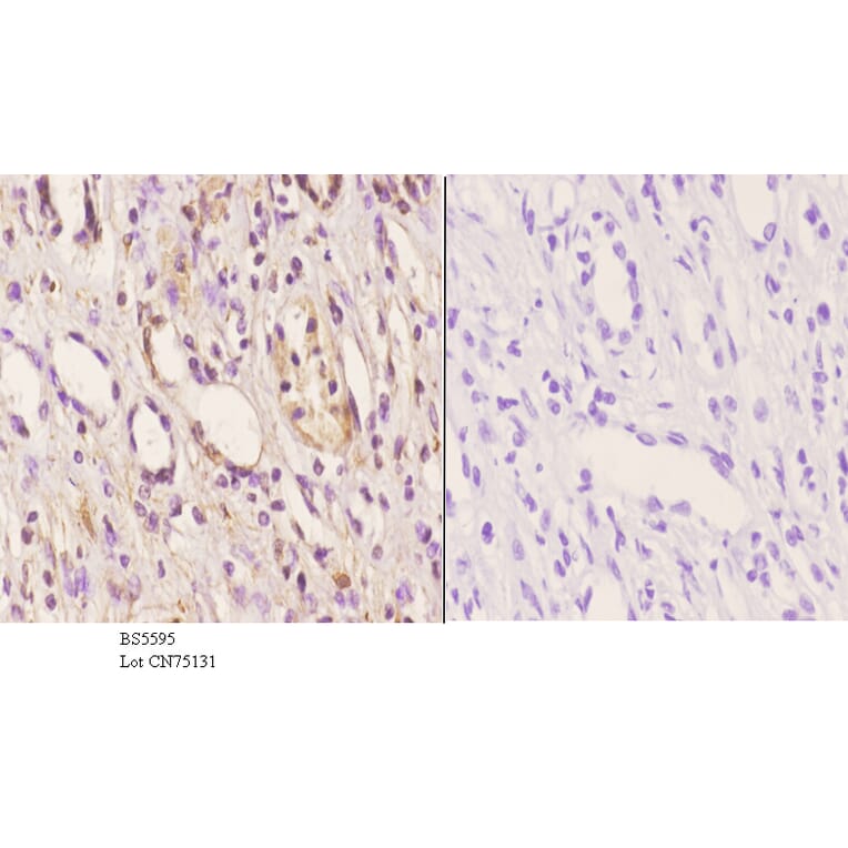 Anti-ABCD4 Antibody from Bioworld Technology (BS5595) - Antibodies.com