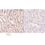 Anti-ABCD4 Antibody from Bioworld Technology (BS5595) - Antibodies.com