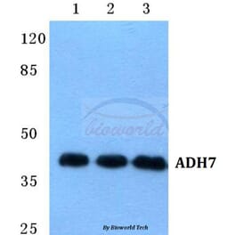 Anti-ADH7 Antibody from Bioworld Technology (BS5600) - Antibodies.com