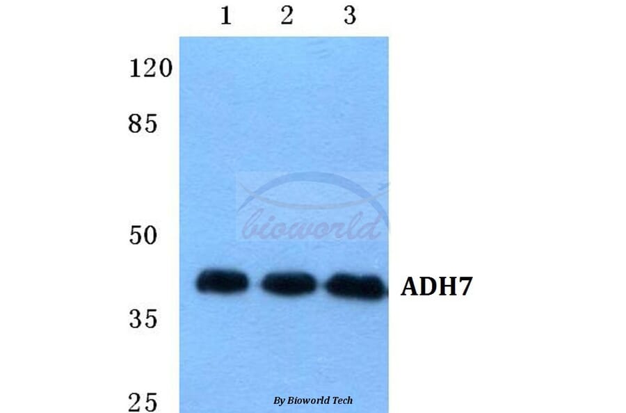 Anti-ADH7 Antibody from Bioworld Technology (BS5600) - Antibodies.com