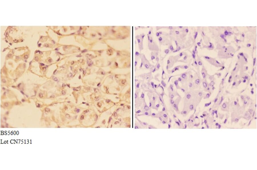 Anti-ADH7 Antibody from Bioworld Technology (BS5600) - Antibodies.com