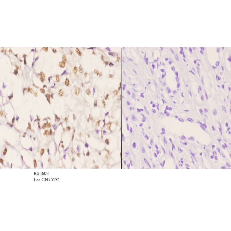 Anti-AKAP8 Antibody from Bioworld Technology (BS5602) - Antibodies.com