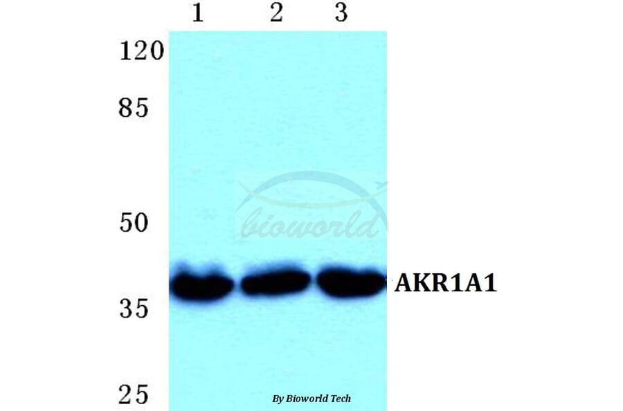 Anti-AKR1A1 Antibody from Bioworld Technology (BS5603) - Antibodies.com