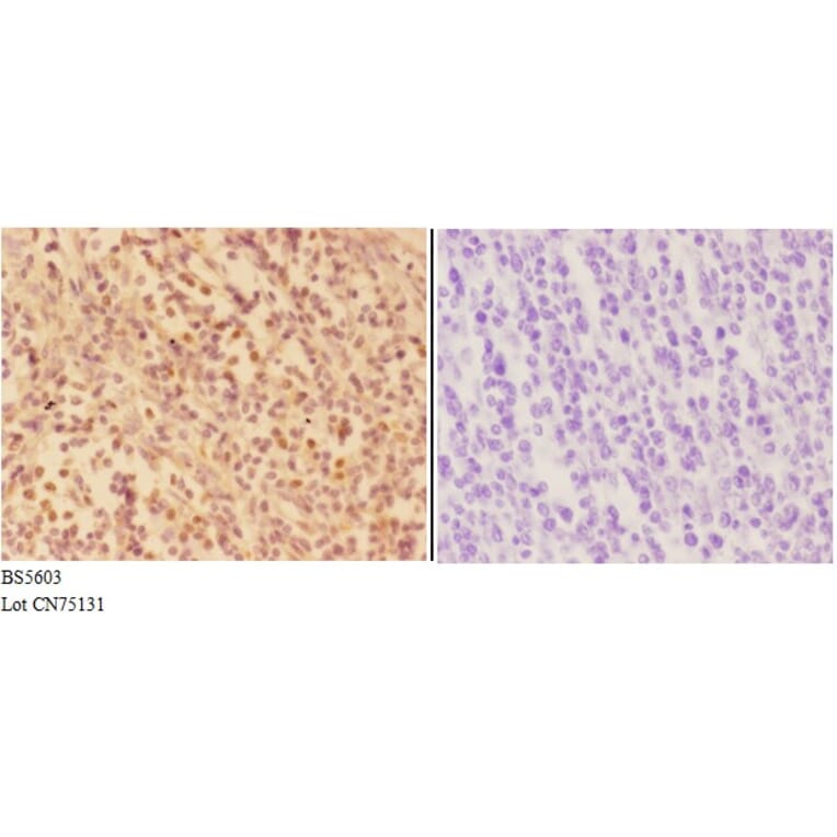 Anti-AKR1A1 Antibody from Bioworld Technology (BS5603) - Antibodies.com