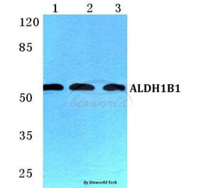 Anti-ALDH1B1 Antibody from Bioworld Technology (BS5604) - Antibodies.com