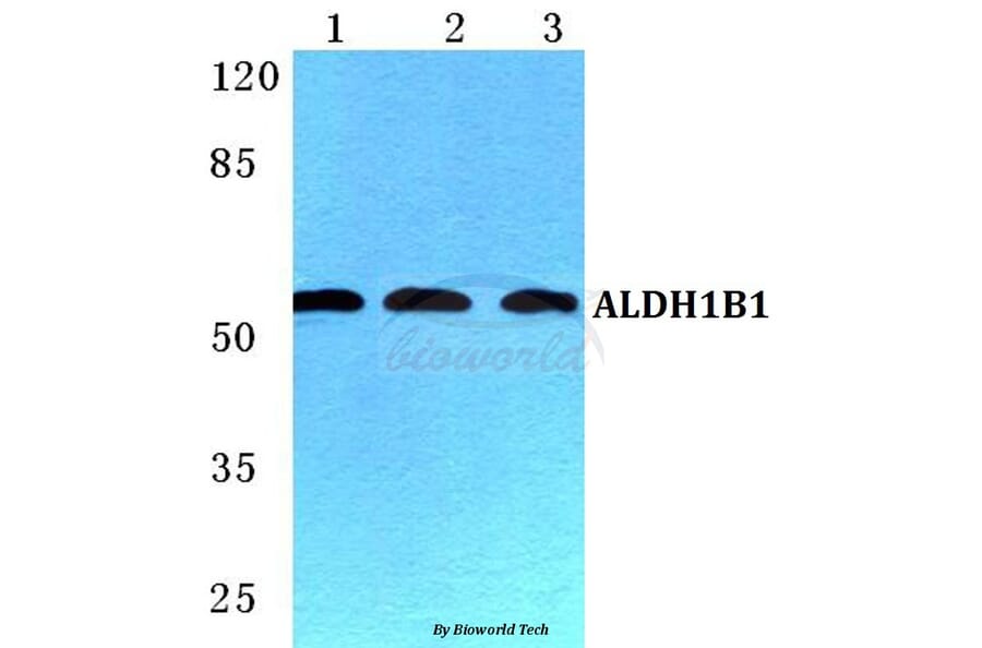 Anti-ALDH1B1 Antibody from Bioworld Technology (BS5604) - Antibodies.com