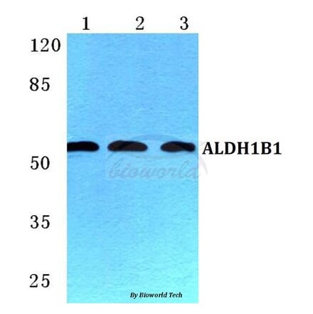 Anti-ALDH1B1 Antibody from Bioworld Technology (BS5604) - Antibodies.com